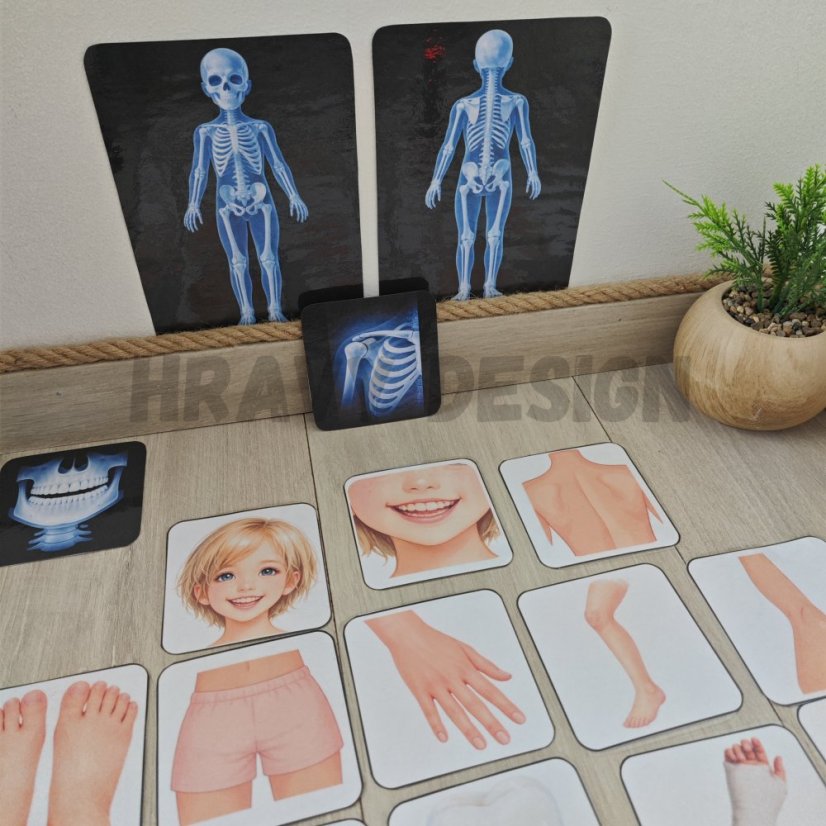 Rentgeny - Lidské tělo - Prosvětlovací obrázky